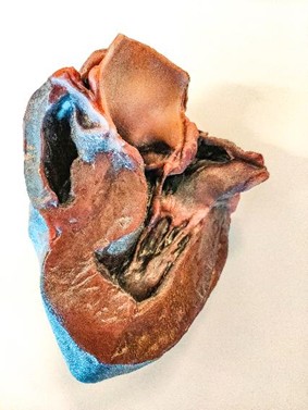 Mimaki 3D printing brings colour to the “beauty” of anatomy